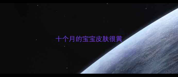 图片 十个月的宝宝皮肤很黄