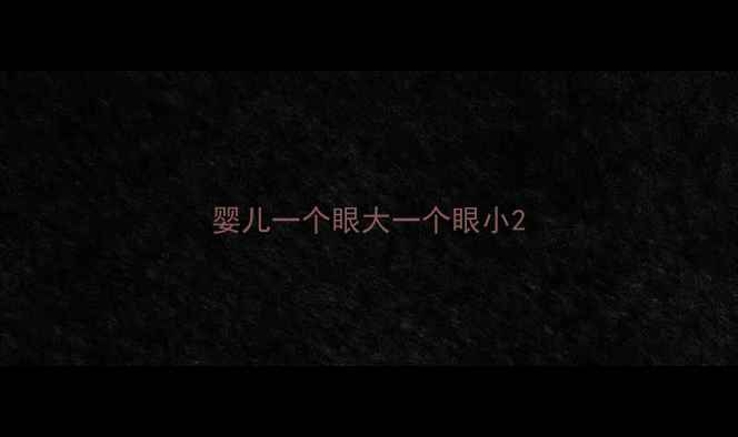 图片 婴儿一个眼大一个眼小2
