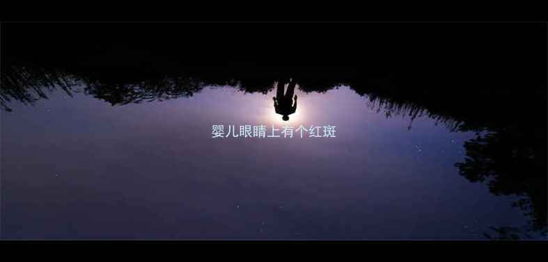 图片 婴儿眼睛上有个红斑
