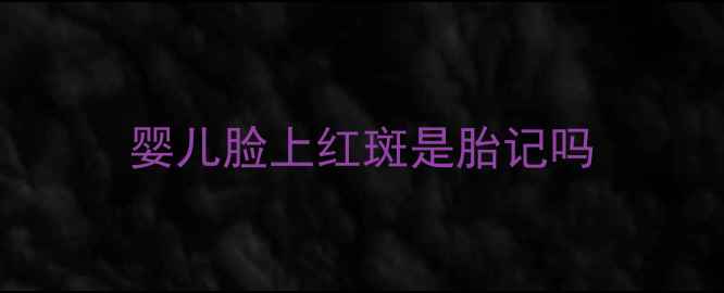 图片 婴儿脸上红斑是胎记吗
